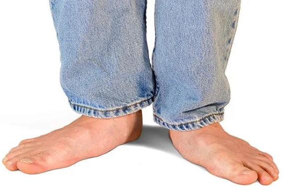 Bàn chân bẹt